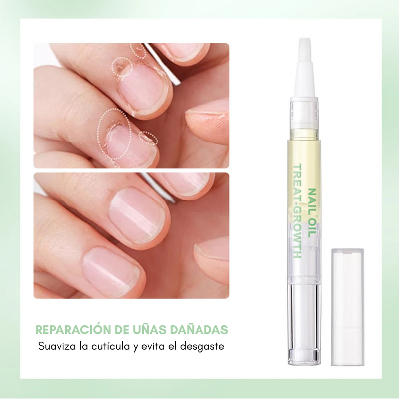 UÑAS YA - [Aceite para aumentar el tamaño de tus uñas] 50% OFF solo por hoy