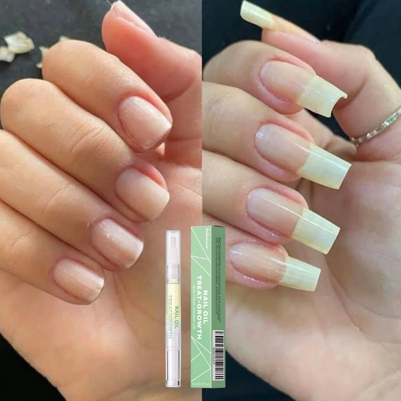 UÑAS YA - [Aceite para aumentar el tamaño de tus uñas] 50% OFF solo por hoy